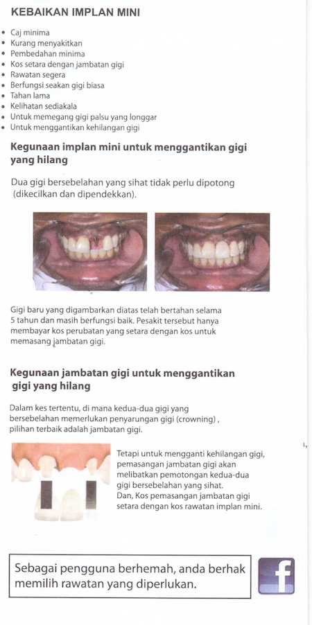 FernandezLim Klang dentistsnearby Brochure3