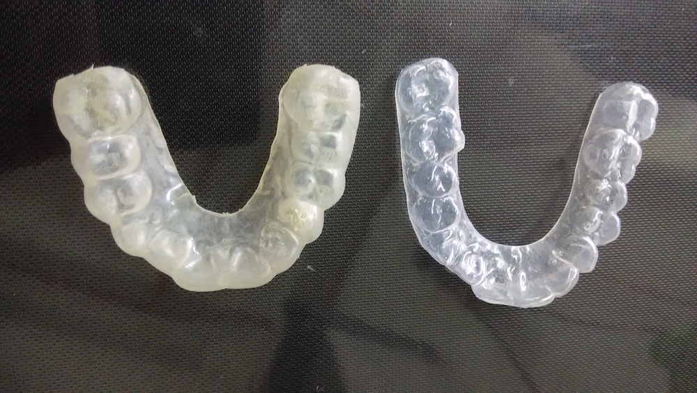 edward-tay-bruxism-appliance-1