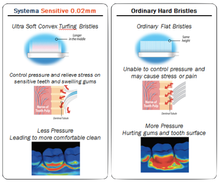 systema-sensitive-diagram-dentistsnearby