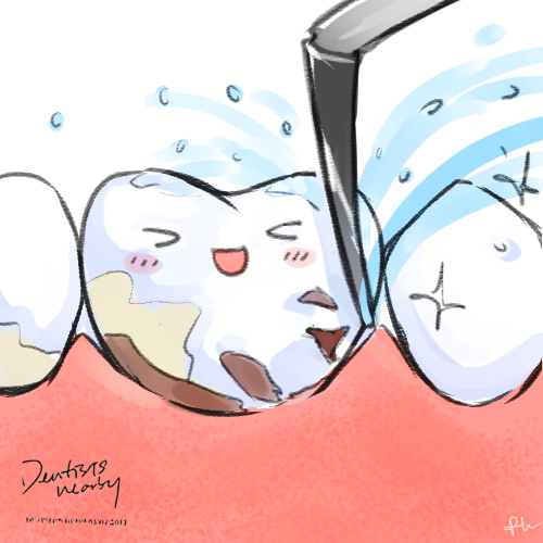 tooth-dental-scaling-off-plaque-illustration-dentistsnearby